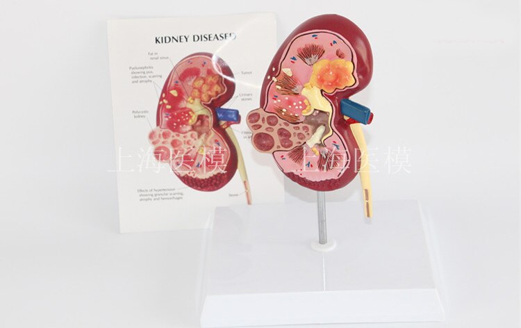 Nierziekte model urologie nier nephron renale glomerulus nier anatomisch model