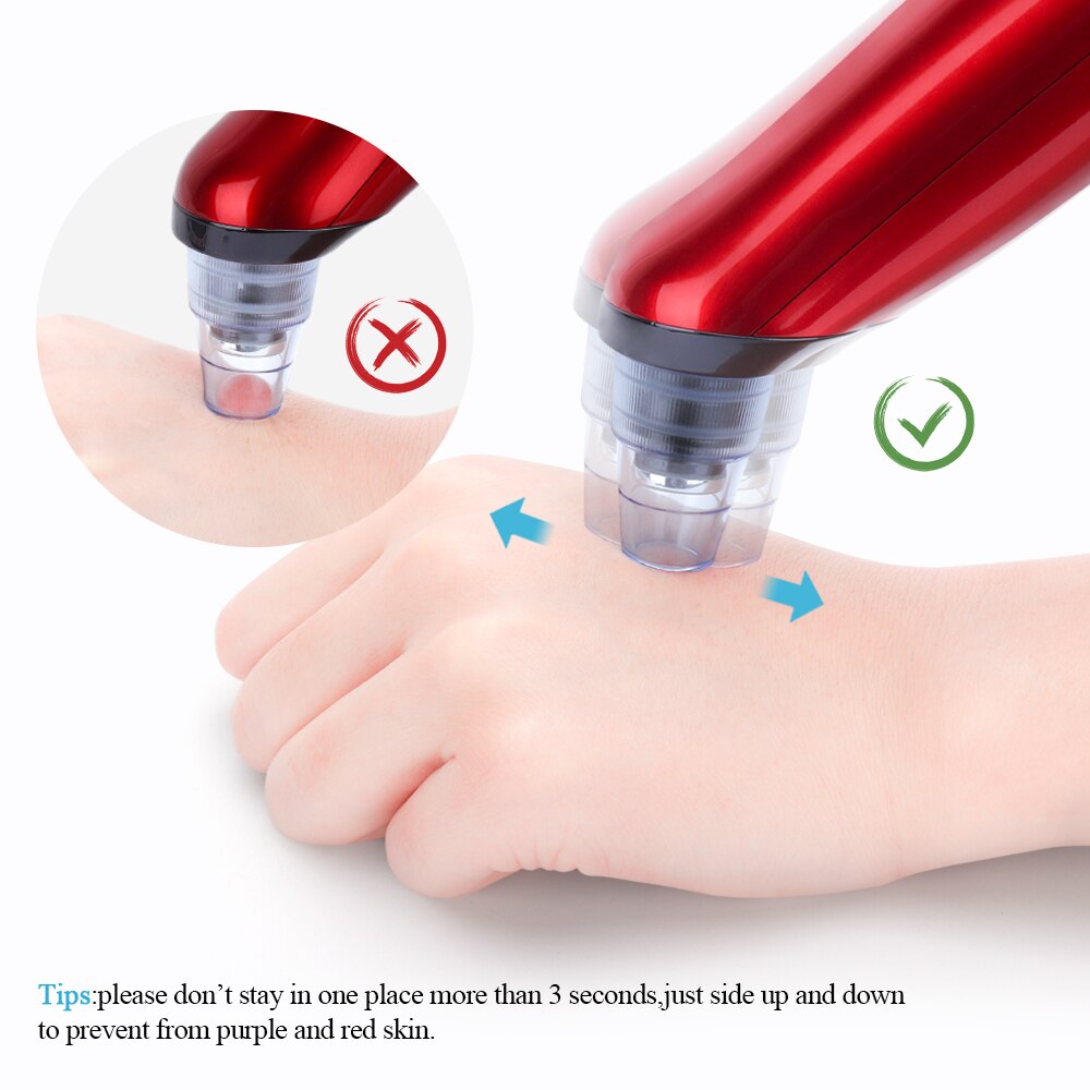 Blackhead Remover Electric Face Acne Black Dot Pimple Microcrystalline Blackhead Vacuum Cleaner Pore Blackhead Skin Care Tools