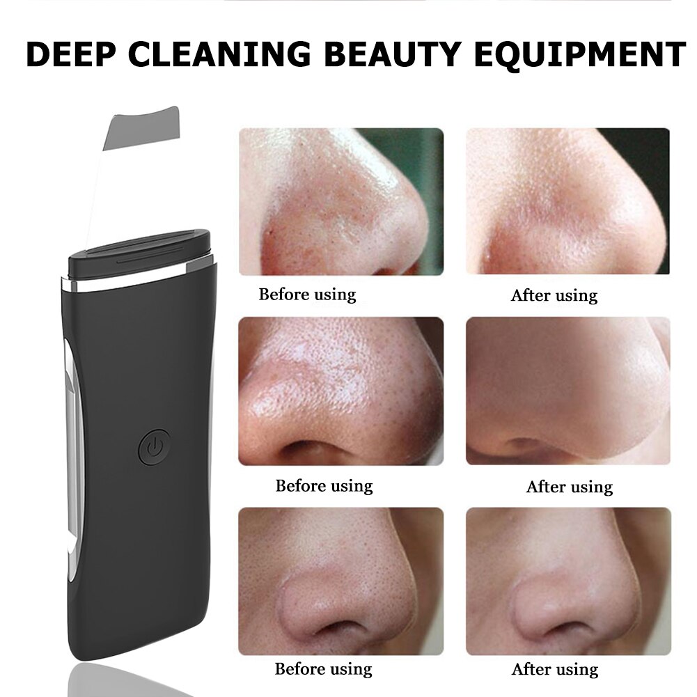 Ultrasonic Skin Scrubber Deep Face Cleaning Machine Peeling Shovel Facial Pore Cleaner Face Skin Scrubber Lift Machine