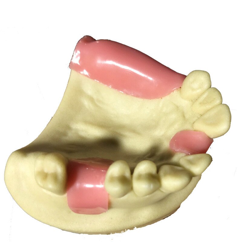 Práctica de sutura gingival suave de 7 tipos, formación Dental, implante de simulación de práctica de implante, modelo de dientes faltantes osteoaxilares