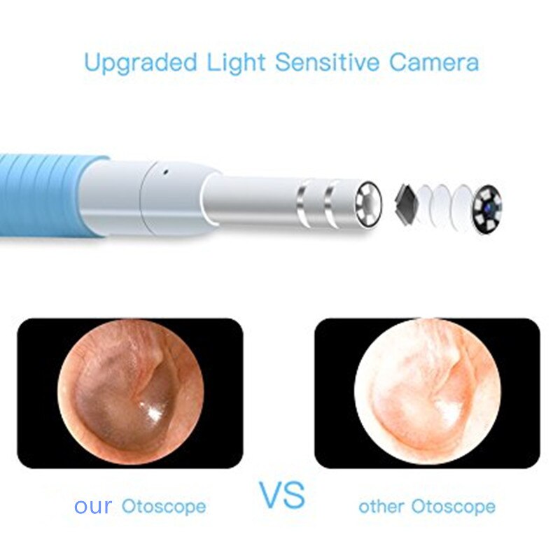 Mini Ear Endoscope Camera 3 in1 Ear Cleaning Android USB Endoscope 5.5mm Visual Ear Spoon Earpick Otoscope Camera