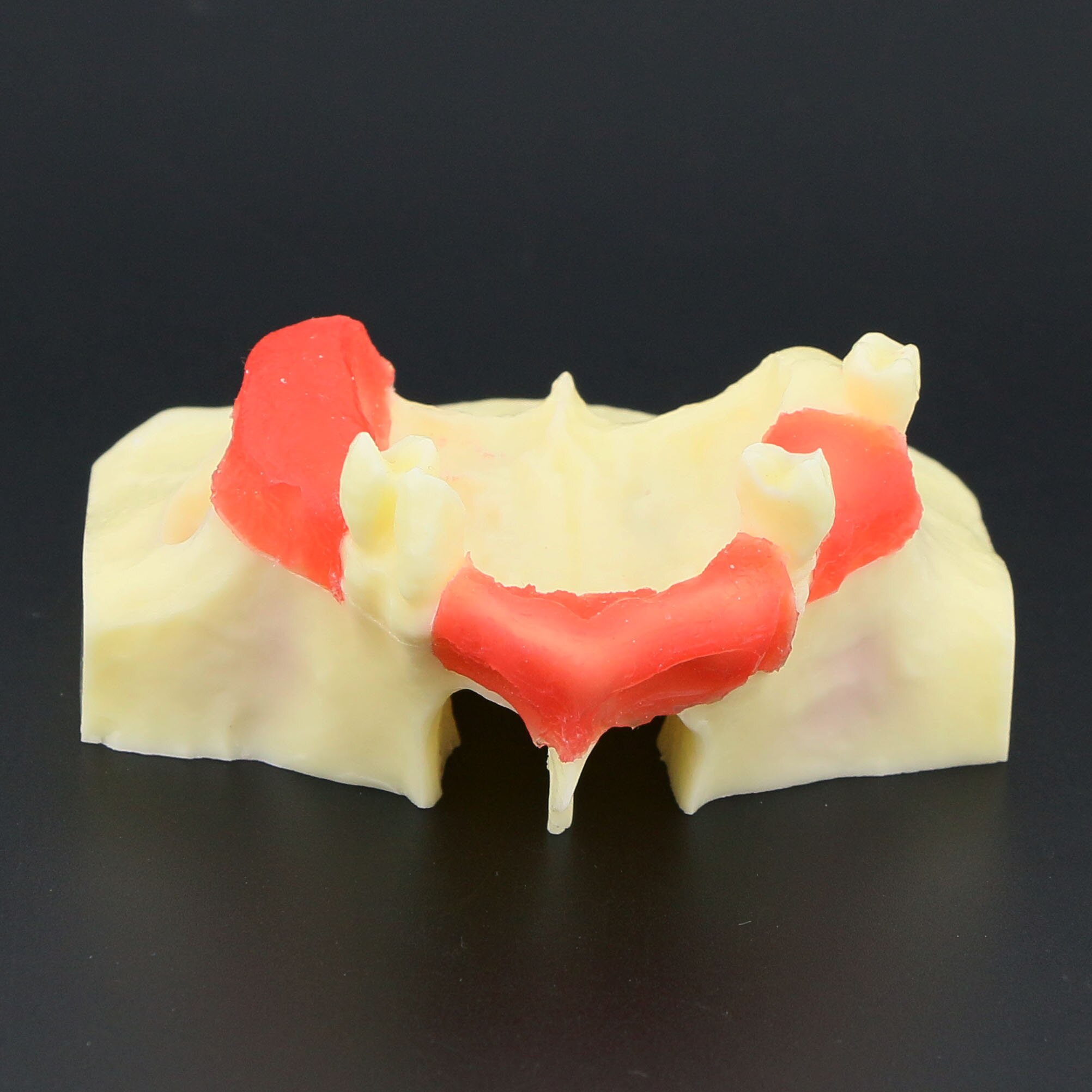 Dental Implant Teeth Model M2012 Typodont Maxillary Sinus Lift Practice Model Resin Tooth Demo For Teaching Study