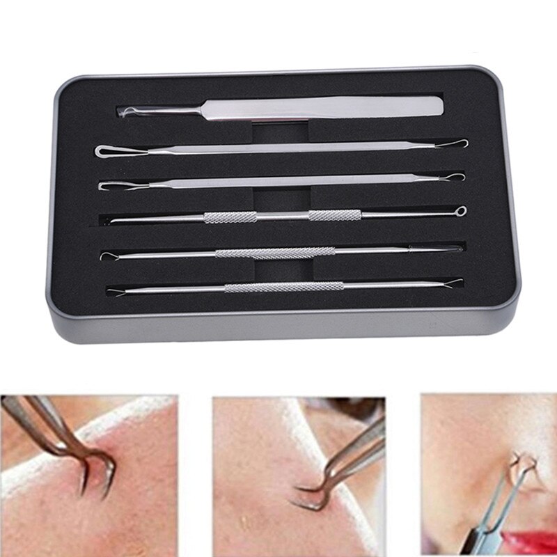 6 Pcs/set Blackhead Remover Pimple Blemish Comedone Acne Extractor Remover Tool Set Acne Removal Needle