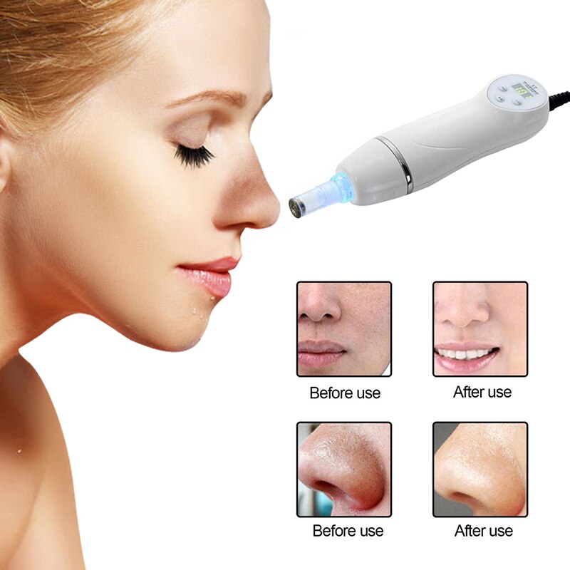 Dissolvant de points noirs visage profond nez nettoyant diamant Peeling dispositif enlèvement de points noirs peau peau diamant Dermabrasion Massage du visage