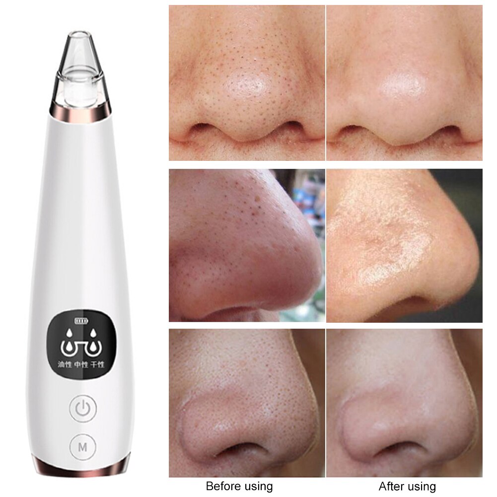 Electric Blackhead Remover Vacuum Suction Facial Pore Cleaner w/Suction Tip Black Spots Pore Cleaner Machine