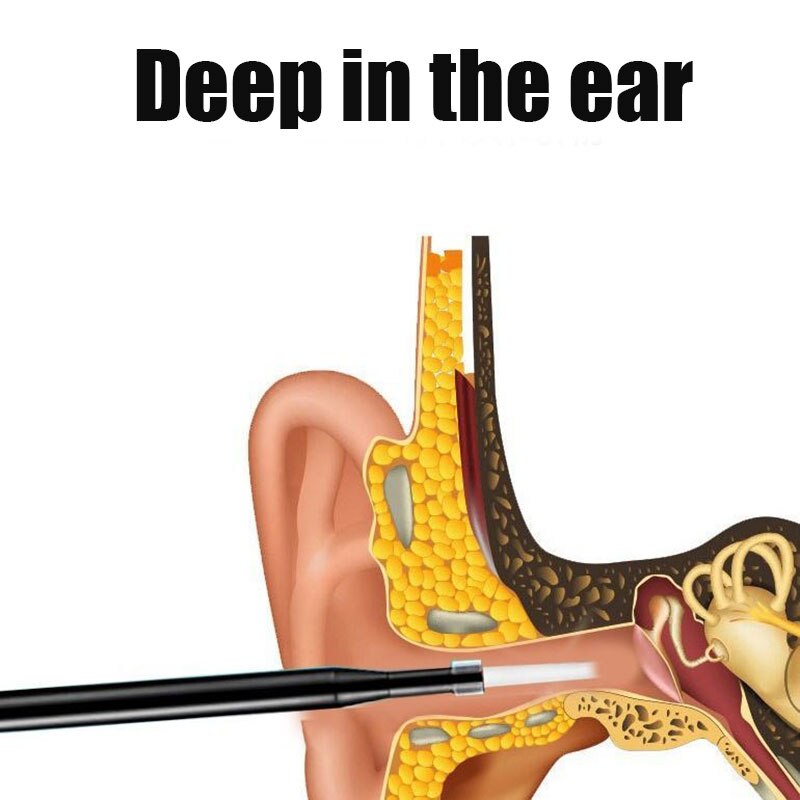 Le cérumen Retrait LED Otoscope Oreille Nettoyage D'endoscope Cuillère Mini Caméra Oreille Sélecteur De Retrait De Cire D'oreille M2