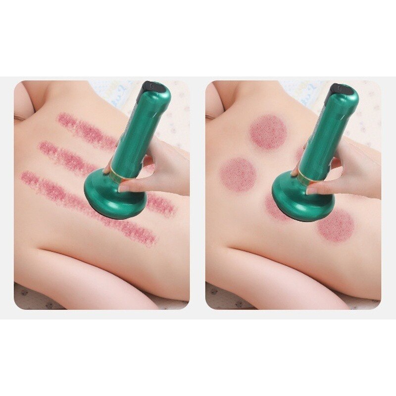 Gua Sha – grattoir électrique Anti-Cellulite, brûleur de graisse, masseur à ventouses, chauffage méridien, drague, appareil Guasha, nouvel arrivage 2022