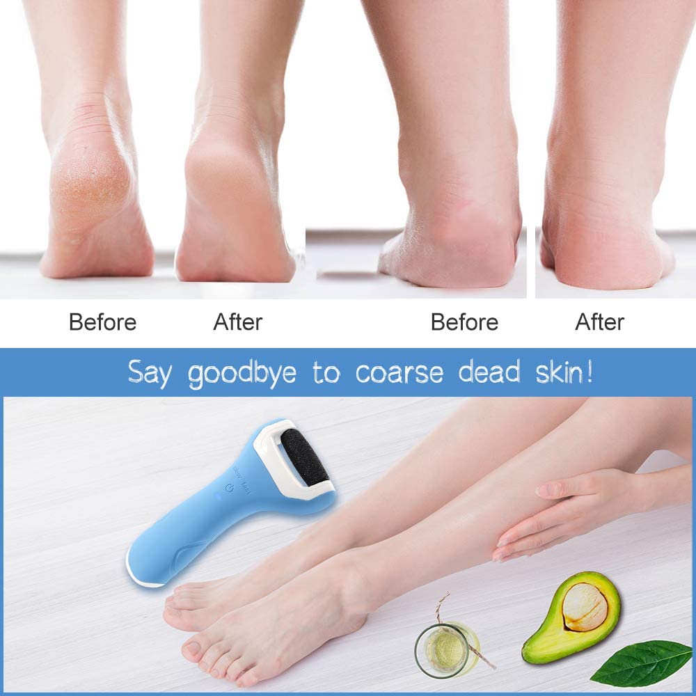 Foot File Electric Hard Skin Remover Foot Pedicure Callus Remover USB Rechargeable Foot Care Tool with 2 Roller Heads