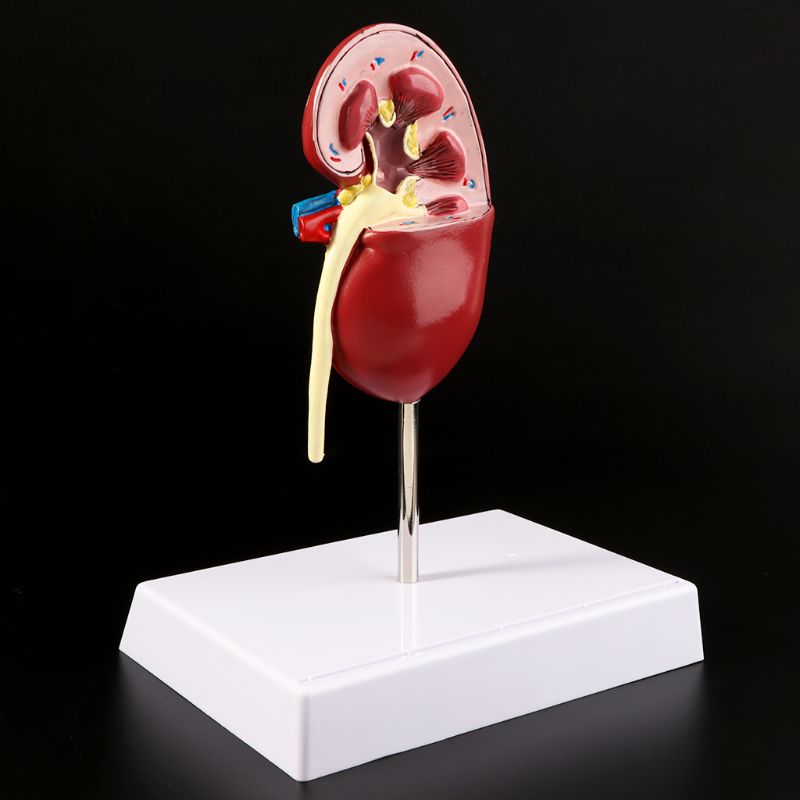 Life Size Human Kidney Diseased Model Anatomical Anatomy Diseased Pathological Stone Organ Teaching Supplies D5QC
