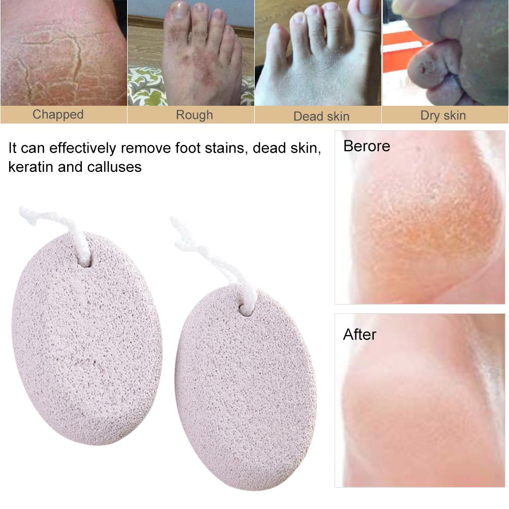 Piedra pómez Natural, Lima para pies, cepillo para quitar durezas y exfoliar, productos de baño para pedicura, herramienta para el cuidado de los pies, 1 unidad