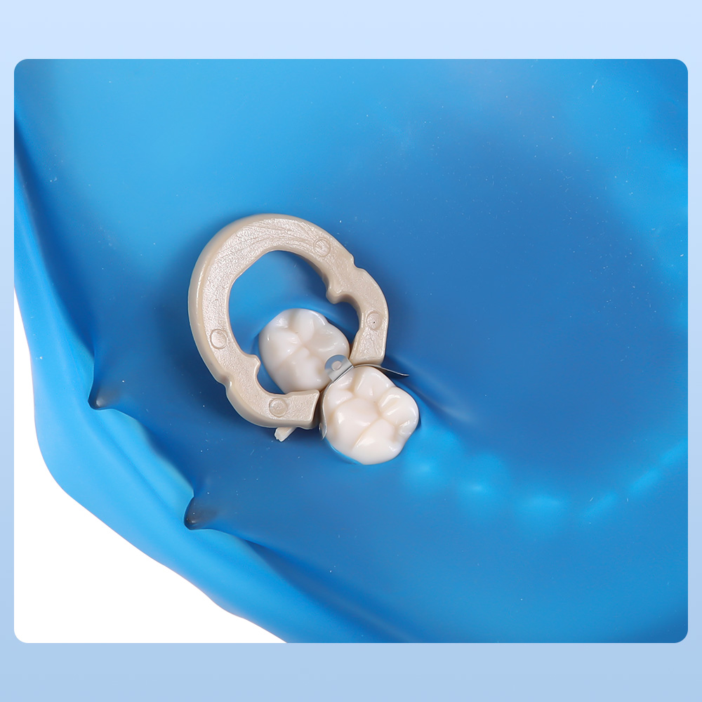 50 Uds bandas de matriz Dental matrices metálicas contorneadas seccionales para reemplazo de dientes Material de odontología