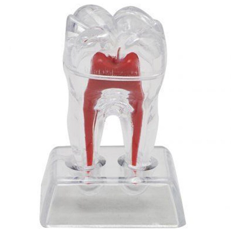 Large Tooth Molar Model Separable Teaching Demonstration Model Transparent Dentistry Material Lab Teeth Model