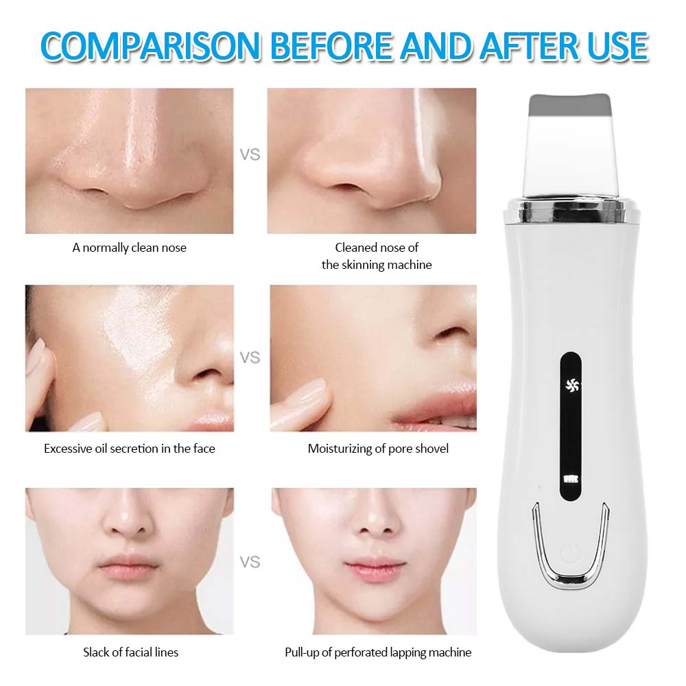 Ultrasonic Skin Scrubber and USB Nebulizer Face Steamer Humidifier Deep Face Cleaning Machine Peeling Shovel Facial Pore Cleaner