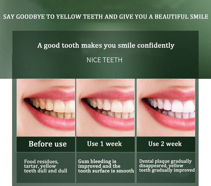 Electric toothbrush ultrasonic USB charger rechargeable waterproof soft toothbrush replaceable brush head set