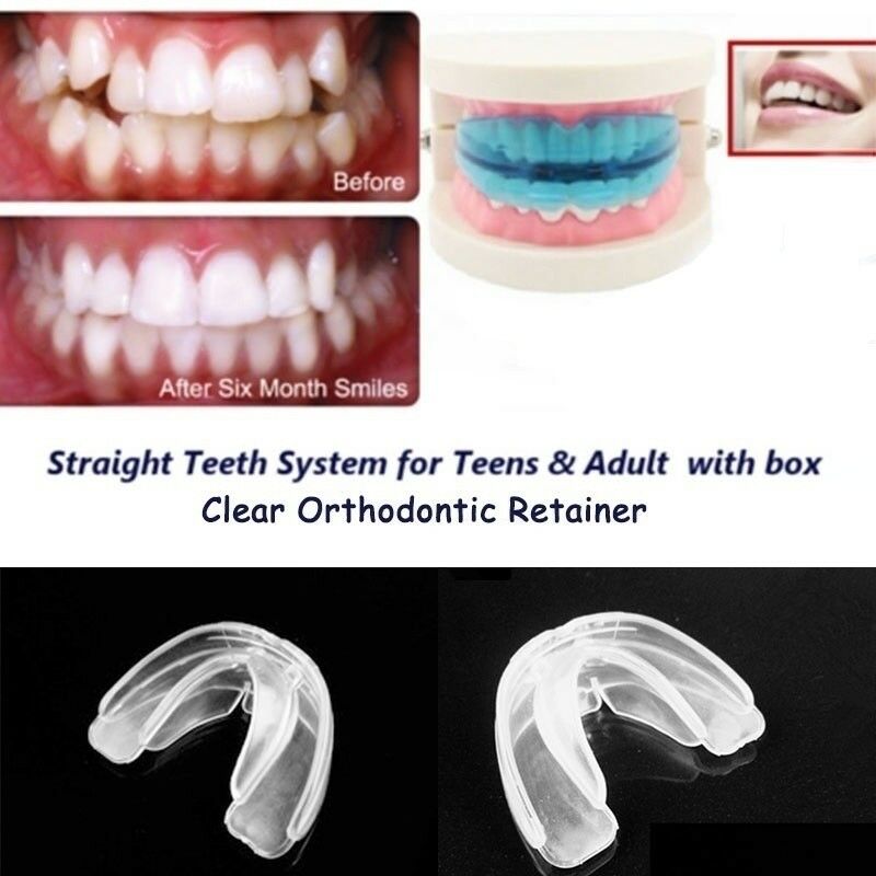 Lige tænder system bid ret tand tænder tandregulering holderen klar