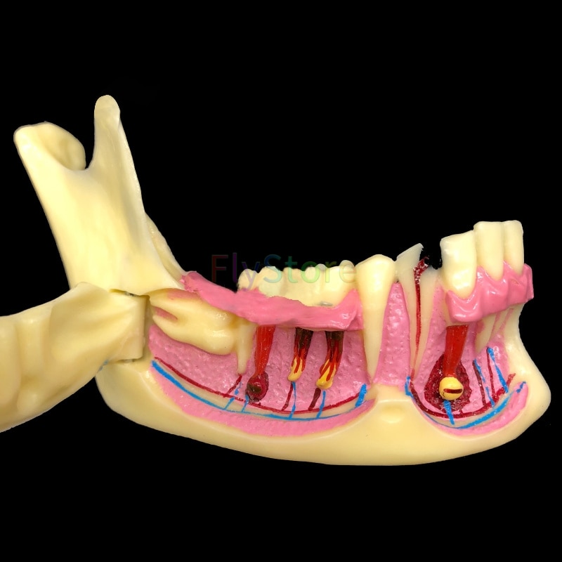 Dental Mandibular Teaching Model Teeth Demonstration Anatomical Study
