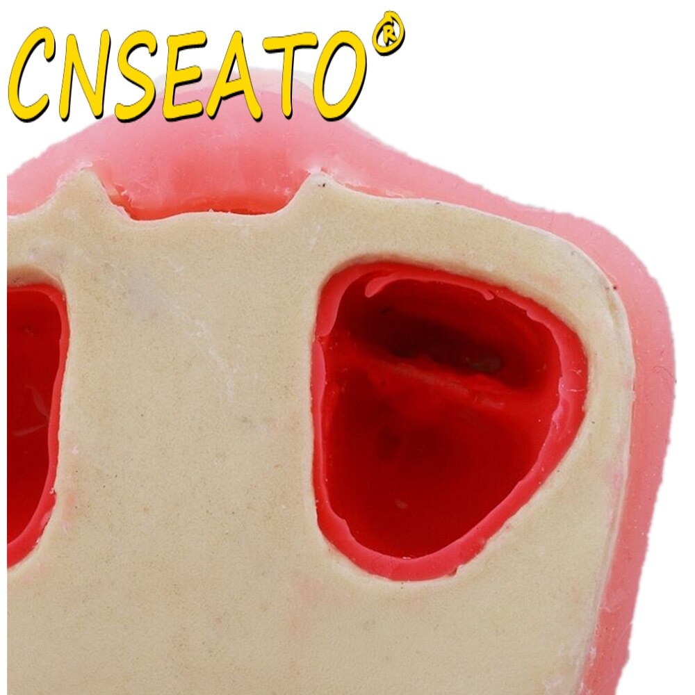 Dental Teeth Model Sinus Lift Practice Maxillary Bone Dentistry Tooth Models Dentist Teaching Demonstration Implant Simulator