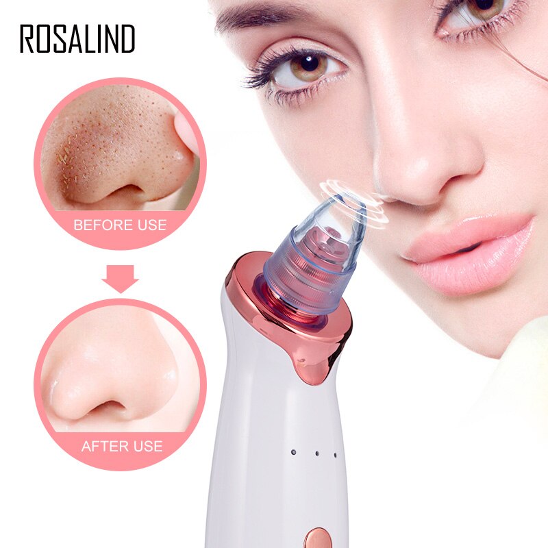 ROSALIND Blackhead Remover Vacuum Cleaner With USB Charging Black Dot Facial Pore Cleaner Pimple Skin Spot Remover Care Tools