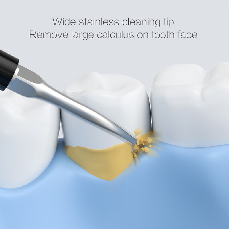 Xiaomi dr.bei elektrisk scaler tandbørste ultralyd tand tandsten fjerner hvidere tænder pletter tandsten fjerne værktøj