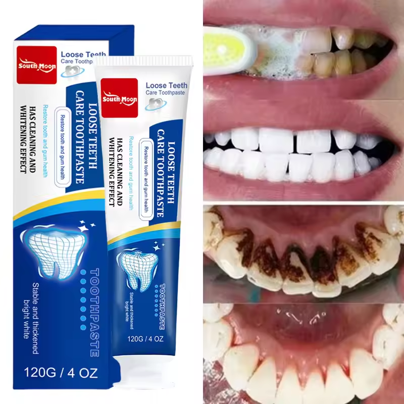 120 g probiotische Karies-Zahnpasta SP 4 aufhellende Zahnkaries-Reparaturpaste, Zahnreiniger, Plaque-Entferner, frischer Atem, Zahnpflege