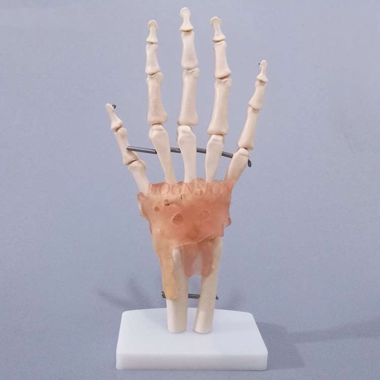Hand Knochen Modell Handgelenk Gemeinsamen Hand Anatomie Knochen Bänder Beweglichen Struktur Phalanx Radius bilden