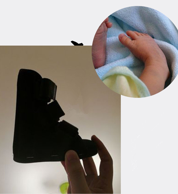 Kids Afo Voet Spalk Baby Ankle Foot Brace Night Spalk Peuter Strephenopodia Strephexopodia Spalk