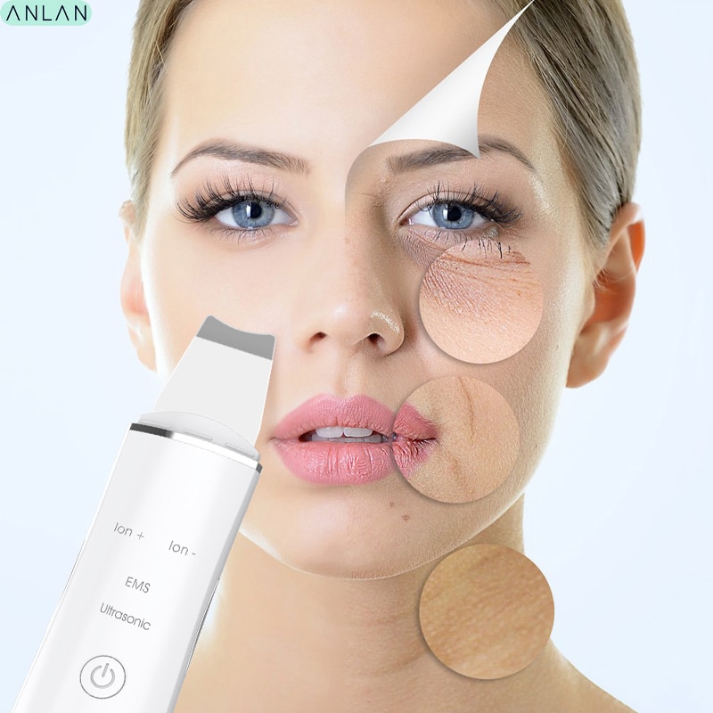 ANLAN Ultrasonic Skin Scrubber Facial Clean Machine Vibration Cleansing Removal Blackhead Exfoliating Rechargeable skin scrubber