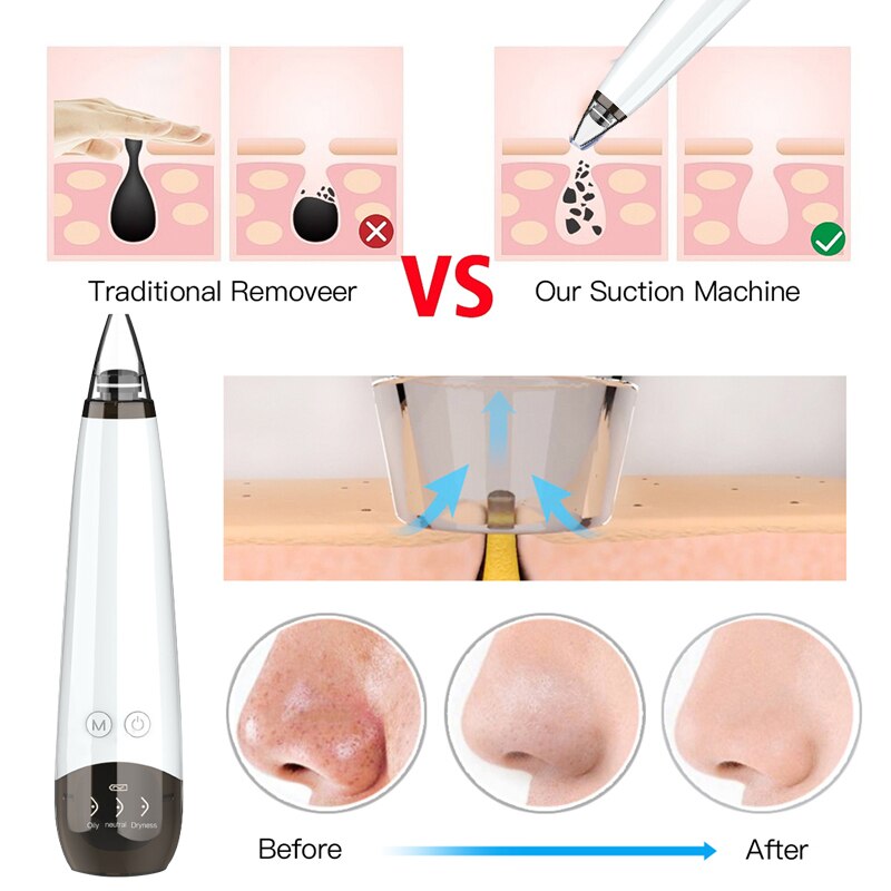 Electric Face Nose Vacuum Blackhead Pore Remover Suction Blackhead Pimple Acne Remover Cleaner with 6 Head Facial Skin Care Tool
