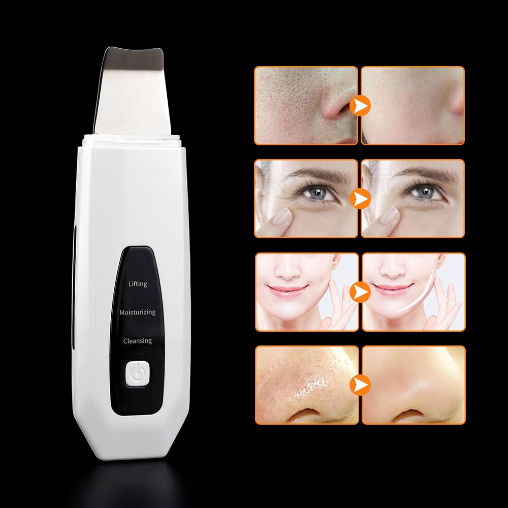 USB Ultrasonic Ion Skin Scrubber Deep Face Pore Cleaning Machine Ultrasound Facial Peeling Exfoliating Device Remove Blackhead