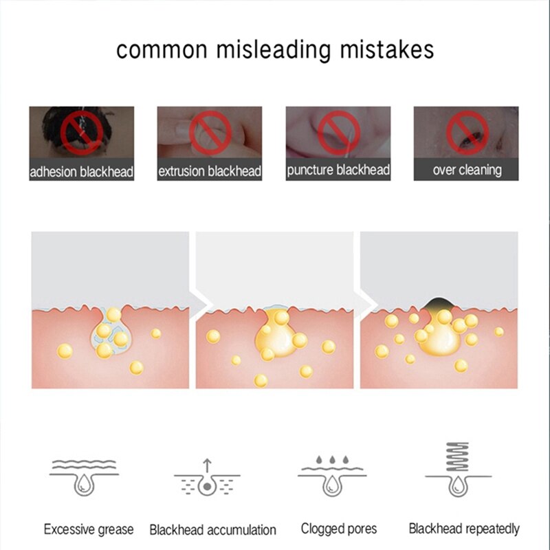 Comedondrukker Vacuüm Zuig Gezicht Huid Bescherming Puistje Remover Tool Porie Reiniging Apparaat Gezicht Schoner Machine