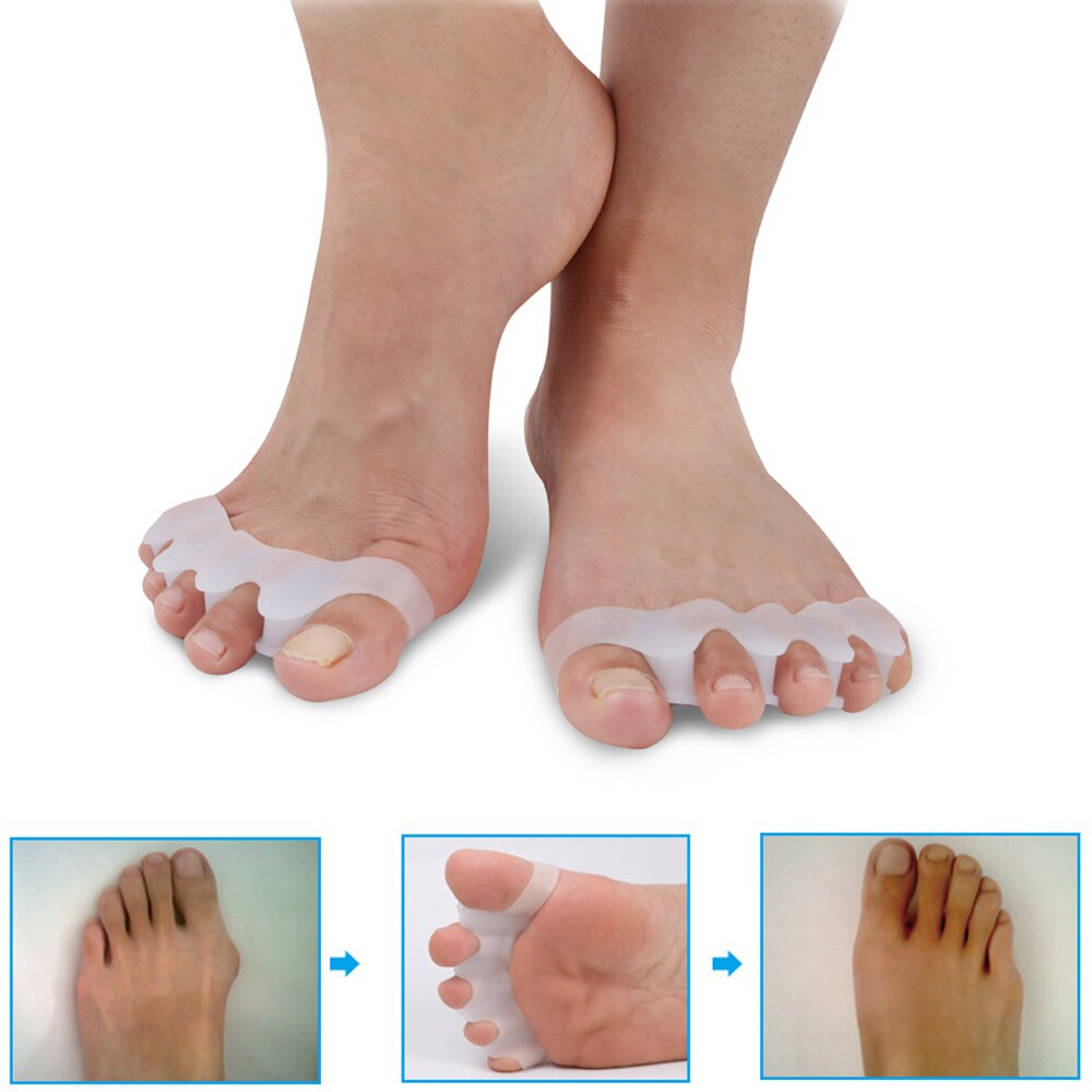 1 par silikone knyst hallux valgus beskytter finger tå adskiller skiller fordeler 4 huller tommelfinger valgus beskyttelse fodpleje værktøj