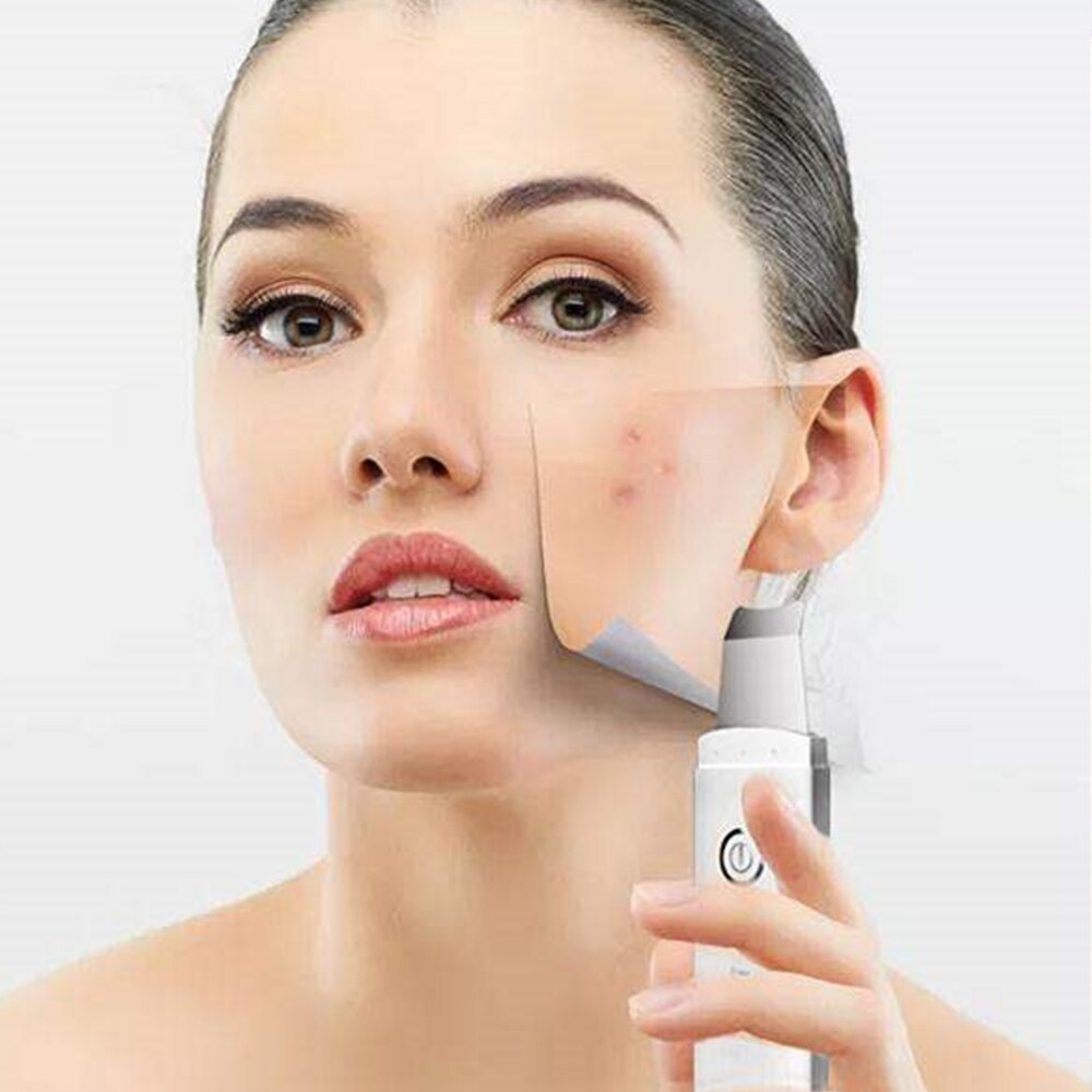 Exfoliador ultrasónico de piel exfoliante Extractor Facial limpieza profunda dispositivo de belleza + rejuvenecimiento de la piel Nano vapor de niebla Facial