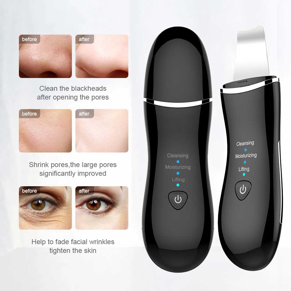 InFace Ultrasound Ion Skin Cleanser Facial Blackhead Pore Cleaner Peeling Shovel Massage Face Health Care Skin Care