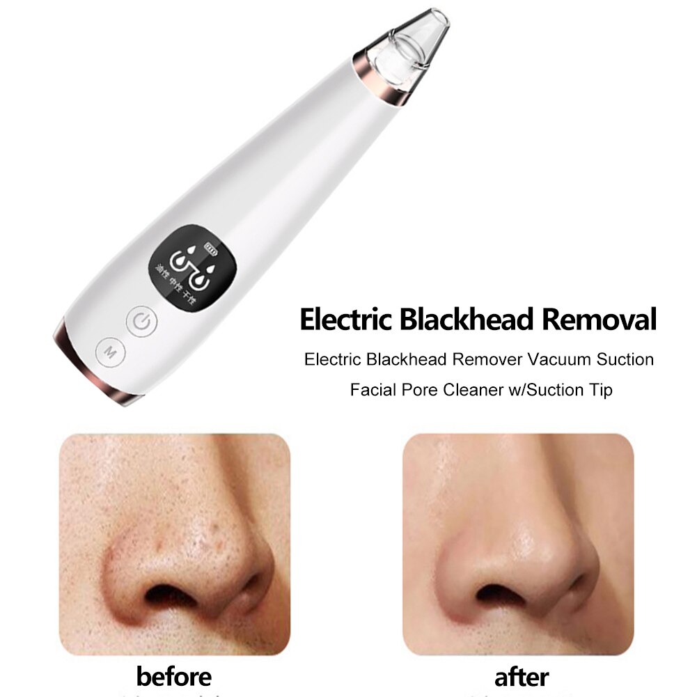 Electric Blackhead Remover Vacuum Suction Facial Pore Cleaner w/Suction Tip Black Spots Pore Cleaner Machine