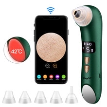 Ckeyin-microscopio eliminador de espinillas, limpiador de poros al vacío, succión de compresa , eliminación de manchas negras, limpieza facial eléctrica, 20X