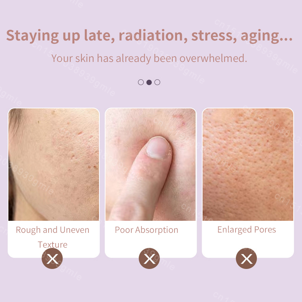 Tweekoppige gezichtsijsroller, gebruikt voor gezichts- en hoofdmassage, gemaakt van harsmateriaal, zonder geur en batterij