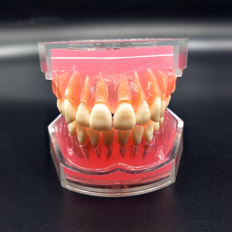 Dental Study Teaching Model Standard Model Removable Teeth Soft Gum ADULT TYPODONT Model
