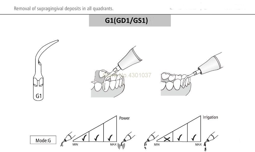 10 Stück Ntal Scaling Endo Perio Tips PS1 Für SIRONA