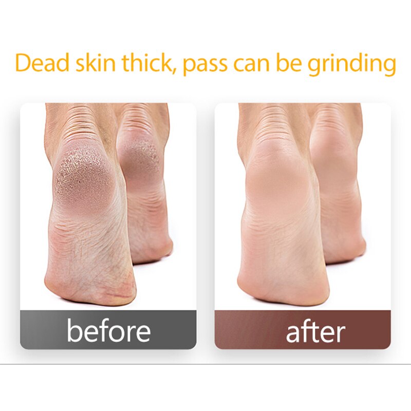 Broca de diamante para unhas, lixa de papel para limpeza de cutículas dos pés, fresa de pele morta, acessórios de manicure e pedicure