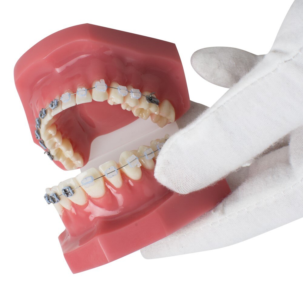 Dental Tanden Studie Orthodontische Rode Model met Metalen en Keramische Brackets Orale Demonstreren Modellen