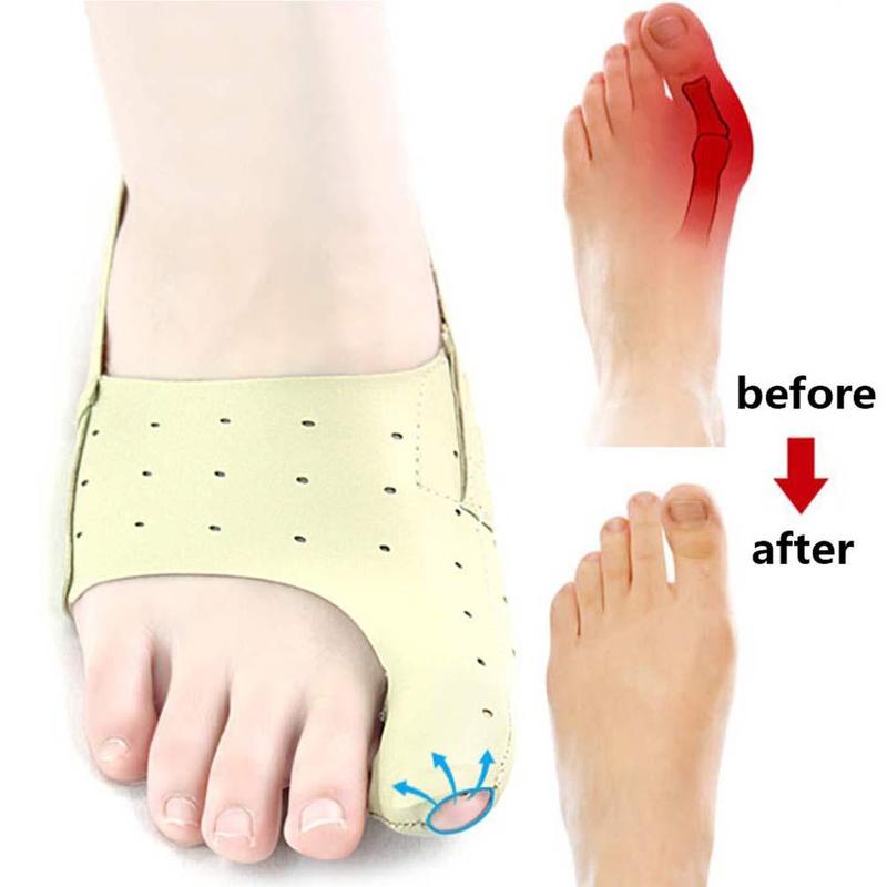 Hallux Valgus Bunion Corrector Orthopedische Voet Gereedschappen Bone