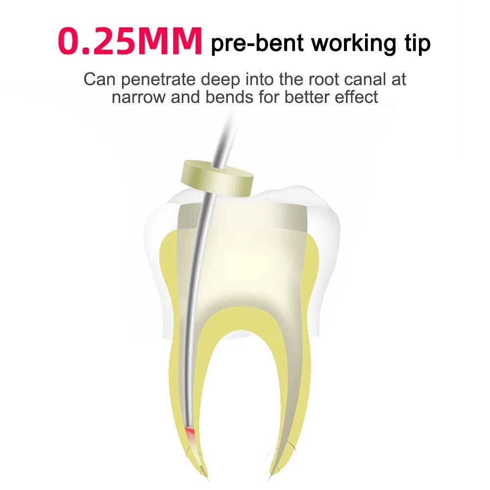 Sistema de obturación de gutapercha Dental, inalámbrico, pluma calentada, Endo, gutapercha, 2 puntas