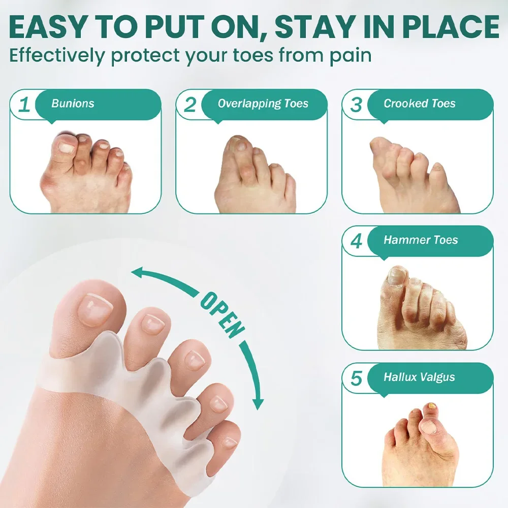 1 par silikon tåseparator hallux valgus korrigerare hammare tåkorrigerare mjukt silikonmaterial för tåseparation fotvårdsverktyg