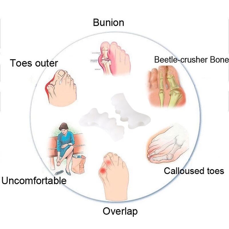 20Pcs = 10Pairs Silicone Hallux Valgus Teen Bescherming Gel Bunion Corrector Voet Vinger Stijltang Care Tools Separator Orthese