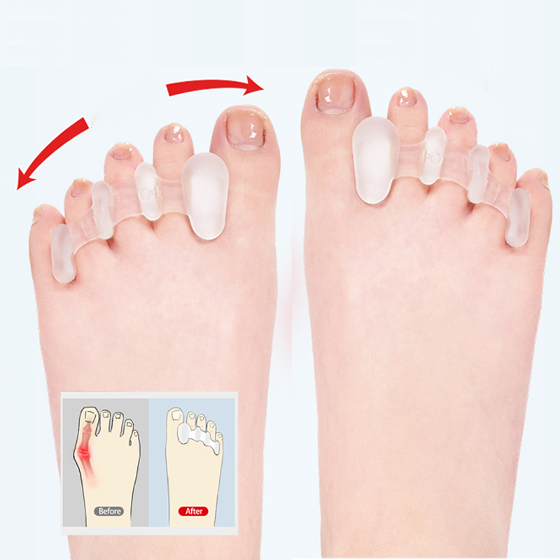 Silikon Zehen Separator Bunion Knochen Ektropion Einsteller Zehen Außen gerät Fußpflege Werkzeuge Hallux Valgus Korrektor