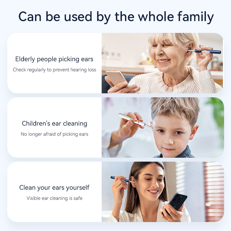 Pinzette per orecchie con fotocamera Strumento visivo per la rimozione del cerume Fotocamera con otoscopio da 12 Megapixel Kit di pulizia visiva del cerume 3 in 1 WiFi