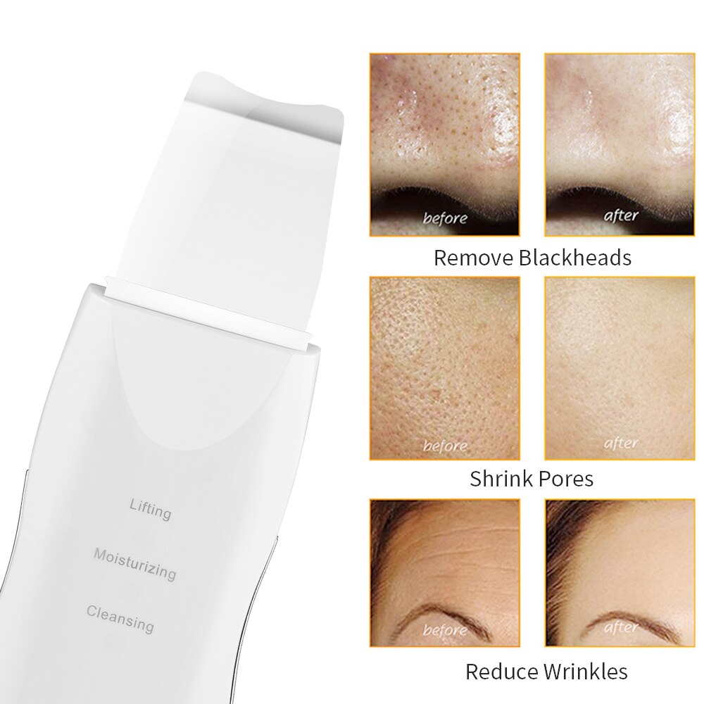 Ultrasonic Scrubber Deep Cleansing Face Scrubber Facial Cleansing Shovel Exfoliating Skin Scraper Peeling Beauty Instrument