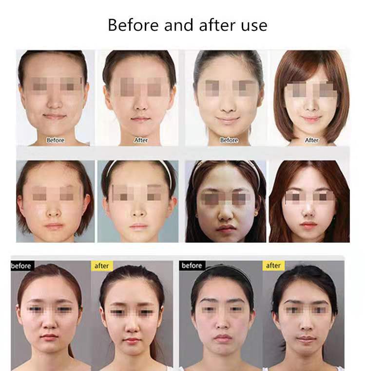 Ultra-thin Thin Face Mask Breathable Face-lifting Artifact V Face Mask To Create Super Thin Face