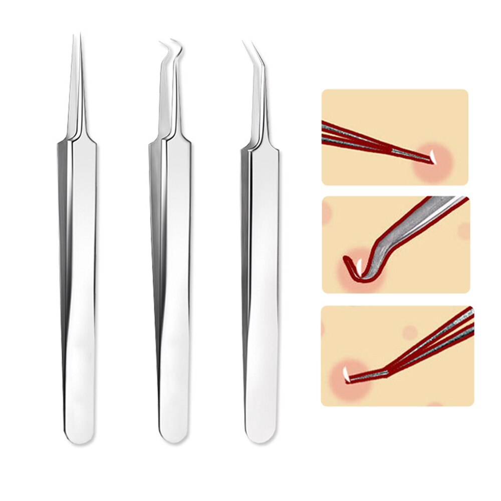 1 pièces pince à épiler professionnelle 3 modèles pour Nail Art/soins du visage/Extension de cils point noir acné défaut bouton supprimer les outils