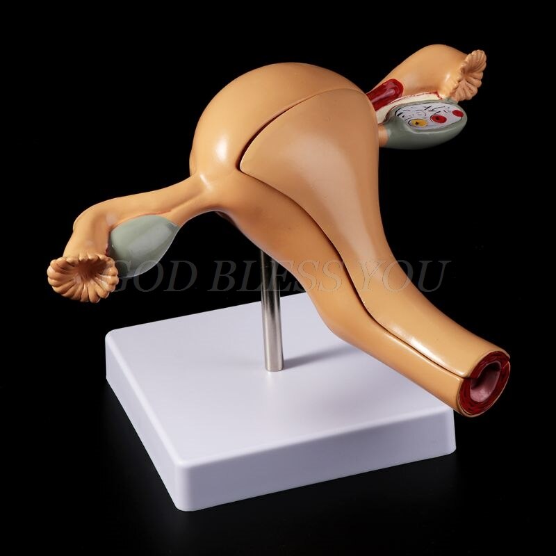 Human Pathological Uterus Ovary Model Anatomical Anatomy Disease Pathology Lesion For Teaching